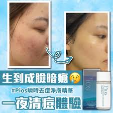！李医生暗疮水的高效使用秘籍，让你肌肤焕新颜！